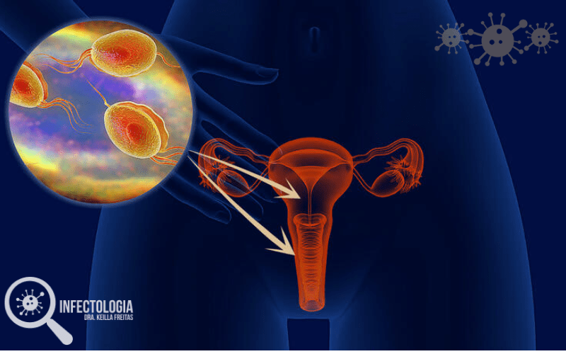 tricomoniase em homem